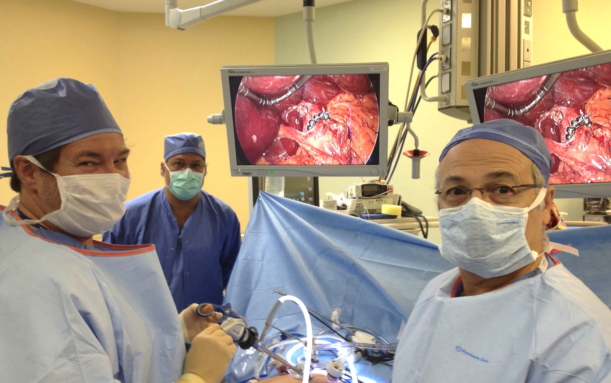 Heartburn Surgery | Marrero, LA | Surgical Clinic of Louisiana