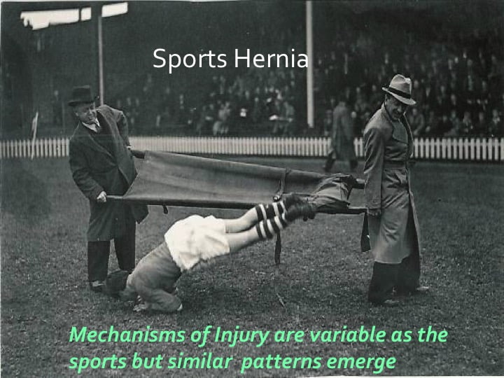 sports hernia